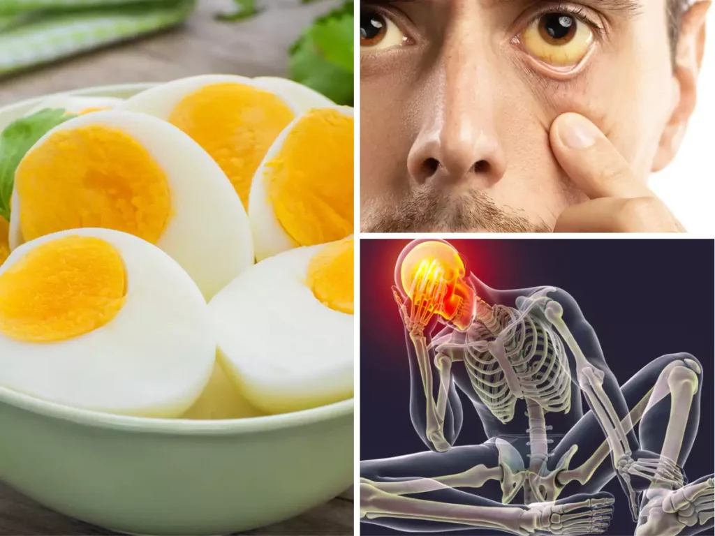 Vitamin B12 deficiency can lead to anemia