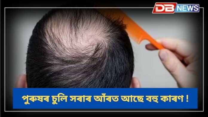 Hair Loss: পুৰুষৰ চুলি কিয় সৰে?
