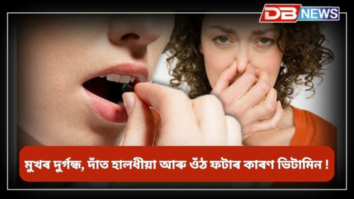 Vitamin: কি ভিটামিনৰ অভাৱত মুখৰ দুৰ্গন্ধ, দাঁত হালধীয়া আৰু ওঁঠ ফাটে