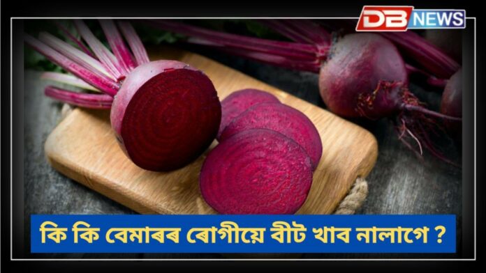 Beetroot: এই পাঁচ ৰোগীয়ে ভুলতেও নাখাব বীট !