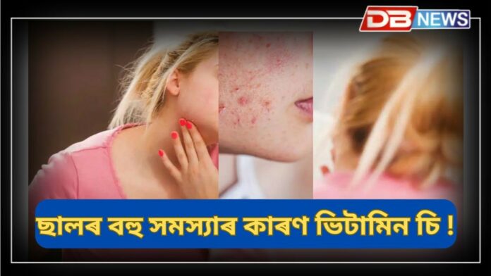 Vitamin C: ভিটামিন চিৰ অভাৱত ছালত দাগ, বলিৰেখা আৰু ছাল ফুলে