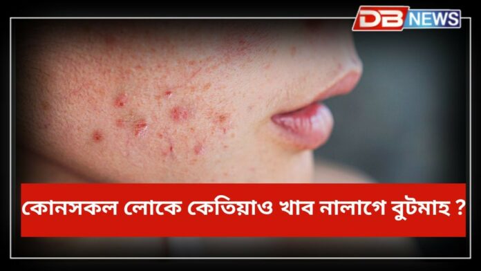 Pimples: কি ভিটামিনৰ অভাৱত গালত পিম্পল ওলাই, কোনসকল লোকে কেতিয়াও খাব নালাগে বুটমাহ ?