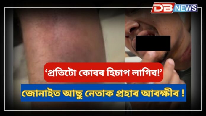 Jonai Assu News: জোনাইত আছু নেতাক প্ৰহাৰ আৰক্ষীৰ !