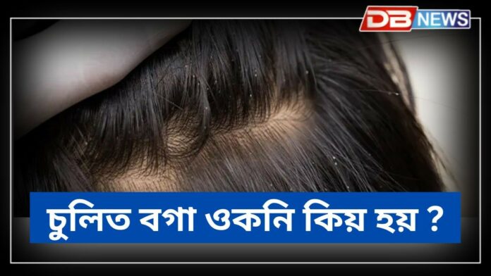 Astro Tips: চুলিত বগা ওকনি হৈছে নেকি ? জানি লওক এয়া শুভ নে অশুভ লক্ষণ !