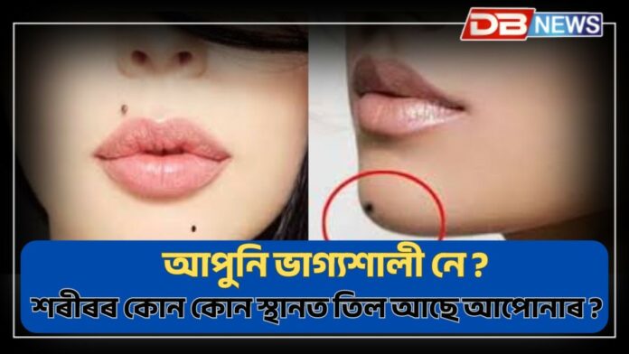 Moles: আপোনাৰ মুখৰ তিলৰ অৰ্থঃ শৰীৰৰ ক'ত ক'ত তিল থাকিলে ভাগ্যশালী হয় ?