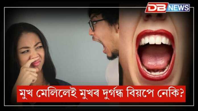 Mouth Smell: মুখ মেলিলেই মুখৰ দুৰ্গন্ধৰ বাবে লাজত পৰে নেকি?