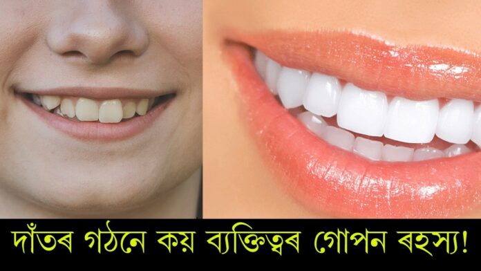 Teeth Shape: বগা দাঁত থকা মানুহৰ ভাগ্য হীৰাৰ দৰে জিলিকে