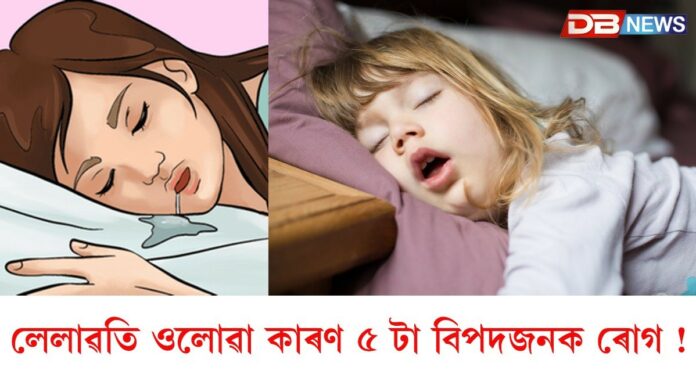 Drooling: ৰাতি টোপনিত লেলাৱতি ওলাই নেকি ? এই ৫ টা বিপদজনক ৰোগৰ কাৰণ হ'ব পাৰে !