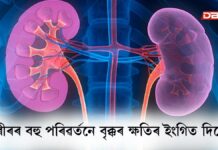 Kidney: কেৱল প্ৰস্ৰাৱে নহয়, শৰীৰৰ বহু পৰিৱৰ্তনে বৃক্কৰ ক্ষতিৰ ইংগিত দিয়ে ! কেৱল প্ৰস্ৰাৱে নহয়, শৰীৰৰ বহু পৰিৱৰ্তনে বৃক্কৰ ক্ষতিৰ ইংগিত দিয়ে !