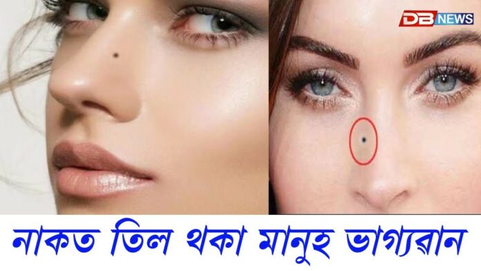 আপোনাৰো নাকৰ তলত তিল আছে নেকি ?