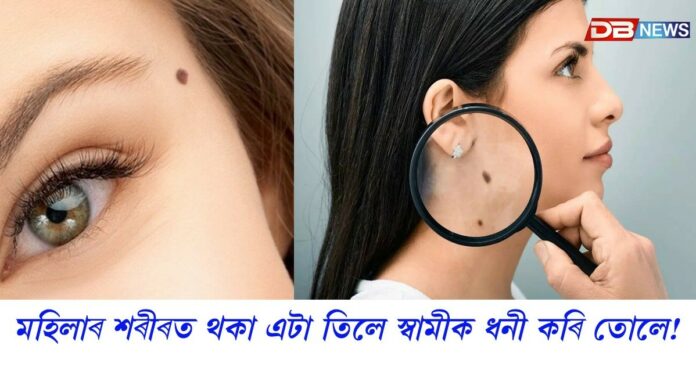 মহিলাৰ শৰীৰত থকা এটা তিলে স্বামীক ধনী কৰি তোলে !